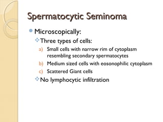 Spermatocytic SeminomaSpermatocytic Seminoma
Microscopically:
Three types of cells:
a) Small cells with narrow rim of cytoplasm
resembling secondary spermatocytes
b) Medium sized cells with eosonophilic cytoplasm
c) Scattered Giant cells
No lymphocytic infiltration
 