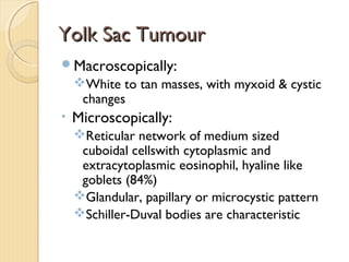Yolk Sac TumourYolk Sac Tumour
Macroscopically:
White to tan masses, with myxoid & cystic
changes
• Microscopically:
Reticular network of medium sized
cuboidal cellswith cytoplasmic and
extracytoplasmic eosinophil, hyaline like
goblets (84%)
Glandular, papillary or microcystic pattern
Schiller-Duval bodies are characteristic
 