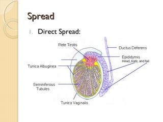 SpreadSpread
1. Direct Spread:
 