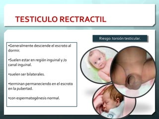 •Generalmente desciende el escroto al
dormir.
•Suelen estar en región inguinal y /o
canal inguinal.
•suelen ser bilaterales.
•terminan permaneciendo en el escroto
en la pubertad.
•con espermatogénesis normal.
Riesgo: torsión testicular.
TESTICULO RECTRACTIL
 