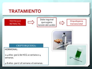 TESTICULO
RETRÁCTIL
Dolor inguinal
que sugiera
torsión del cordón
Orquidopexia
transescrotal
CRIPTORQUIDEA:
HORMONAL:
1-4 años: 500 U de HCG 2x semana x 4
semanas.
4-8 años: 500 U 2X semana x 6 semanas.
TRATAMIENTO
 