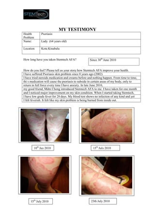 MY TESTIMONY
Health       Psoriasis
Problem
Name:        Lady (64 years old)

Location     Kota Kinabalu


How long have you taken Stemtech AFA?               Since 30th June 2010


How do you feel? Please tell us your story how Stemtech AFA improve your health.
I have suffered Psoriasis skin problem since 8 years ago (2002)
I have tried steroids medication and creams before and nothing happen. From time to time,
thi s medication will cause the psoriasis to subside in certain areas of my body, only to
return in full force every time I have anxiety. In late June 2010,
my good friend, Mdm Chong introduced Stemtech AFA to me. I have taken for one month
and I noticed major improvement on my skin condition. When I started taking Stemtech,
I have low grade fever for 28 days. My blood test shows no infection of any kind and yet
I felt feverish. It felt like my skin problem is being burned from inside out.




        10th Juy 2010                                 15th July 2010




     15th July 2010                                  23th July 2010
 