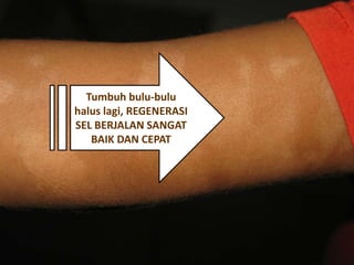 Tumbuh bulu-bulu
halus lagi, REGENERASI
SEL BERJALAN SANGAT
BAIK DAN CEPAT
 