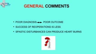 GENERAL COMMENTS
• POOR DIAGNOSIS POOR OUTCOME
• SUCCESS OF REOPERATIONS IS LESS
• SPASTIC DISTURBANCES CAN PRODUCE HEART BURNS
 