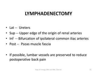 LYMPHADENECTOMY
• Lat -- Ureters
• Sup -- Upper edge of the origin of renal arteries
• Inf -- Bifurcation of ipsilateral common iliac arteries
• Post -- Psoas muscle fascia
• If possible, lumbar vessels are preserved to reduce
postoperative back pain
31
Dept of Urology, GRH and KMC, Chennai.
 