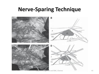 Nerve-Sparing Technique
43
Dept of Urology, GRH and KMC, Chennai.
 