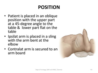 POSITION
• Patient is placed in an oblique
position with the upper part
at a 45-degree angle to the
table & lower part flat on the
table
• Ipsilat arm is placed in a sling
with the arm bent at the
elbow
• Contralat arm is secured to an
arm board
47
Dept of Urology, GRH and KMC, Chennai.
 