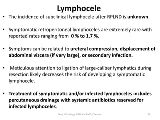 Lymphocele
• The incidence of subclinical lymphocele after RPLND is unknown.
• Symptomatic retroperitoneal lymphoceles are extremely rare with
reported rates ranging from 0 % to 1.7 %.
• Symptoms can be related to ureteral compression, displacement of
abdominal viscera (if very large), or secondary infection.
• Meticulous attention to ligation of large-caliber lymphatics during
resection likely decreases the risk of developing a symptomatic
lymphocele.
• Treatment of symptomatic and/or infected lymphoceles includes
percutaneous drainage with systemic antibiotics reserved for
infected lymphoceles.
57
Dept of Urology, GRH and KMC, Chennai.
 