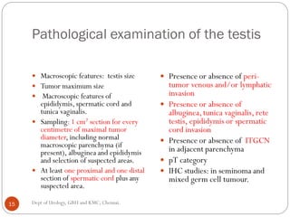 Pathological examination of the testis
 Macroscopic features: testis size
 Tumor maximum size
 Macroscopic features of
epididymis, spermatic cord and
tunica vaginalis.
 Sampling:1 cm2 section for every
centimetre of maximal tumor
diameter, including normal
macroscopic parenchyma (if
present), albuginea and epididymis
and selection of suspected areas.
 At least one proximal and one distal
section of spermatic cord plus any
suspected area.
 Presence or absence of peri-
tumor venous and/or lymphatic
invasion
 Presence or absence of
albuginea,tunica vaginalis, rete
testis, epididymis or spermatic
cord invasion
 Presence or absence of ITGCN
in adjacent parenchyma
 pT category
 IHC studies: in seminoma and
mixed germ cell tumour.
15 Dept of Urology, GRH and KMC, Chennai.
 