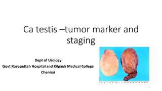 Ca testis –tumor marker and
staging
Dept of Urology
Govt Royapettah Hospital and Kilpauk Medical College
Chennai
1
 