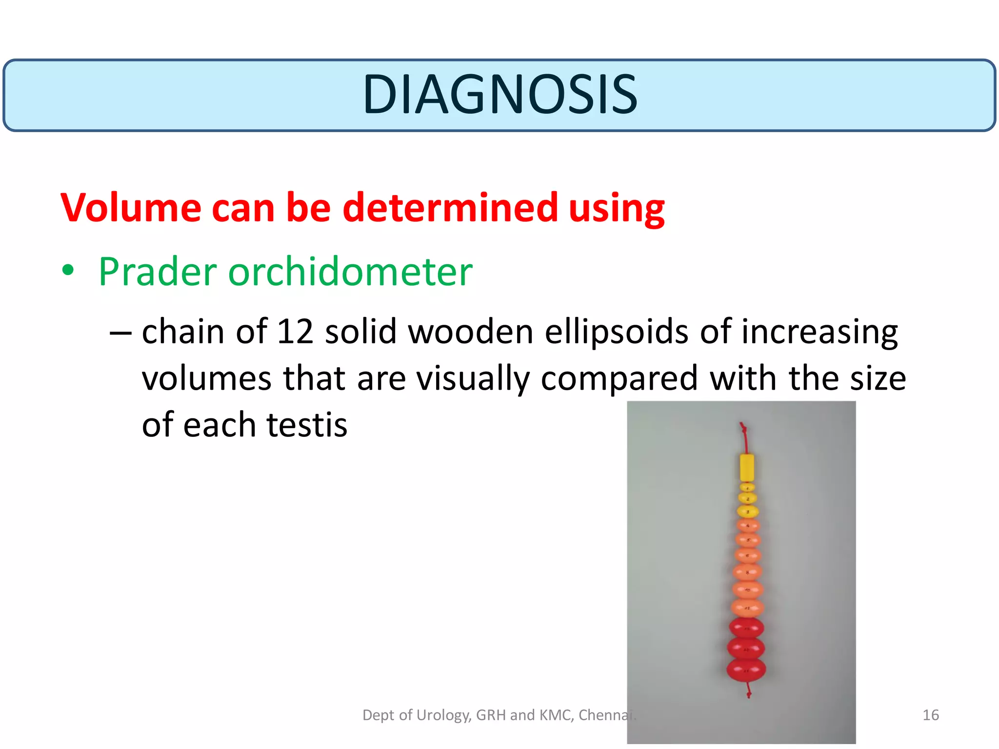 DIAGNOSIS
Volume can be determined using
• Prader orchidometer
– chain of 12 solid wooden ellipsoids of increasing
volumes that are visually compared with the size
of each testis
16
Dept of Urology, GRH and KMC, Chennai.
 