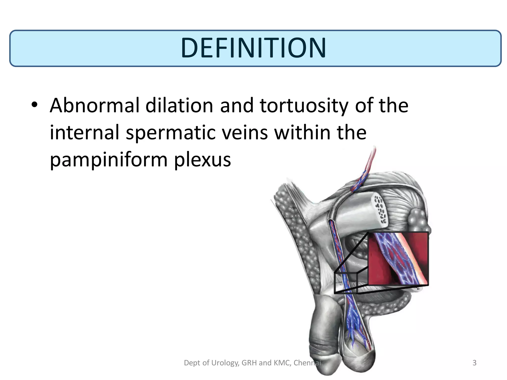 DEFINITION
• Abnormal dilation and tortuosity of the
internal spermatic veins within the
pampiniform plexus
3
Dept of Urology, GRH and KMC, Chennai.
 