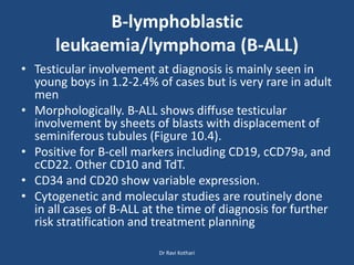 B-lymphoblastic
leukaemia/lymphoma (B-ALL)
• Testicular involvement at diagnosis is mainly seen in
young boys in 1.2-2.4% of cases but is very rare in adult
men
• Morphologically. B-ALL shows diffuse testicular
involvement by sheets of blasts with displacement of
seminiferous tubules (Figure 10.4).
• Positive for B-cell markers including CD19, cCD79a, and
cCD22. Other CD10 and TdT.
• CD34 and CD20 show variable expression.
• Cytogenetic and molecular studies are routinely done
in all cases of B-ALL at the time of diagnosis for further
risk stratification and treatment planning
Dr Ravi Kothari
 