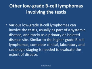 Other low-grade B-cell lymphomas
involving the testis
• Various low-grade B-cell lymphomas can
involve the testis, usually as part of a systemic
disease, and rarely as a primary or isolated
disease site. Similar to the higher grade B-cell
lymphomas, complete clinical, laboratory and
radiologic staging is needed to evaluate the
extent of disease.
Dr Ravi Kothari
 