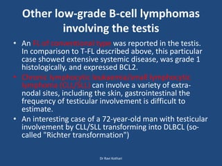 Other low-grade B-cell lymphomas
involving the testis
• An FL of conventional type was reported in the testis.
In comparison to T-FL described above, this particular
case showed extensive systemic disease, was grade 1
histologically, and expressed BCL2.
• Chronic lymphocytic leukaemia/small lymphocytic
lymphoma (CLL/SLL) can involve a variety of extra-
nodal sites, including the skin, gastrointestinal the
frequency of testicular involvement is difficult to
estimate.
• An interesting case of a 72-year-old man with testicular
involvement by CLL/SLL transforming into DLBCL (so-
called "Richter transformation")
Dr Ravi Kothari
 