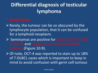 Differential diagnosis of testicular
lymphoma
• Seminoma
Rarely, the tumour can be so obscured by the
lymphocyte population, that it can be confused
for a lymphoid neoplasm.
 Seminomas are positive for SALL4, CD117, OCT-
4, D2-40 and negative for typical lymphoid
markers (Figure 10.9).
Of note, OCT-4 was reported to stain up to 18%
of T-DLBCL cases which is important to keep in
mind to avoid confusion with germ cell tumour.
Dr Ravi Kothari
 