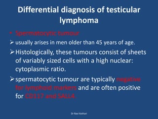 Differential diagnosis of testicular
lymphoma
• Spermatocytic tumour
 usually arises in men older than 45 years of age.
Histologically, these tumours consist of sheets
of variably sized cells with a high nuclear:
cytoplasmic ratio.
spermatocytic tumour are typically negative
for lymphoid markers and are often positive
for CD117 and SALL4.
Dr Ravi Kothari
 