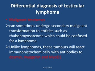 Differential diagnosis of testicular
lymphoma
• Malignant teratomas
can sometimes undergo secondary malignant
transformation to entities such as
rhabdomyosarcoma which could be confused
for a lymphoma.
Unlike lymphomas, these tumours will react
immunohistochemically with antibodies to
desmin, myogenin and MyoD1
Dr Ravi Kothari
 