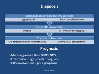 Diagnosis
Prophylactic Treatment
CNS targeted immuno-chemotherapy Contralateral orchidectomy
Check CNS involvement
Imaging CSF immunophenotyping
Initial diagnosis on orchidectomy specimen
Stagging by PET Check Contralateral Testis
Prognosis
•More aggressive than DLBCL NOS
•Low clinical stage – better prognosis
•CNS involvement – poor prognosis
Dr Ravi Kothari
 