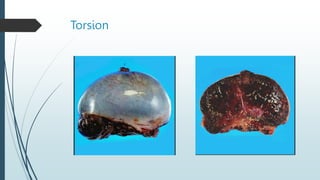 Torsion
 