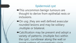 Epidermoid cyst
This uncommon benign tumours are
thought to derive from epithelial rests or
inclusions.
On usg ,they are well defined avascular
rounded lesions and may be solitary
,multiple or bilateral.
Calcification may be present and adopt a
variety of patterns. (multiple foci within
the cyst , curvilinear along the wall or
 