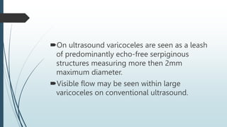 On ultrasound varicoceles are seen as a leash
of predominantly echo-free serpiginous
structures measuring more then 2mm
maximum diameter.
Visible flow may be seen within large
varicoceles on conventional ultrasound.
 