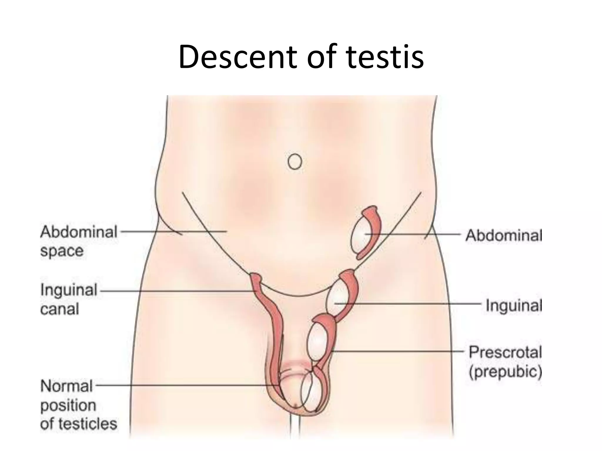 Descent of testis
 