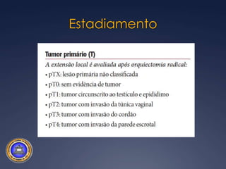 FIVE YEAR SURVIVAL FOR PATIENTS WITH SEMINOMAHistologyStage IStage IIStage IIIClassical	68/71 (95%)   11/19 (58%)	  3/6 (50%)Anaplastic	11/11 (100%)   7/11 (64%)	  2/3 (68%)Cockburn et al.