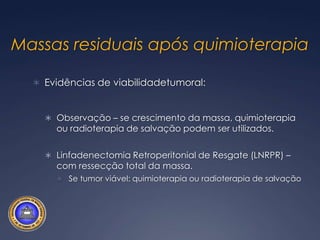 Seminoma EC1Linfadenectomia RetroperitonialNão há recomendação para esta modalidade em paciente neste estádio clínico.  
