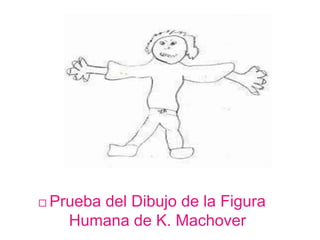  Prueba del Dibujo de la Figura
Humana de K. Machover
Abril-Mayo 2011
 