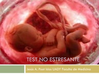 TEST NO ESTRESANTE
Jesús A. Poot Islas UADY Faculta de Medicina
 