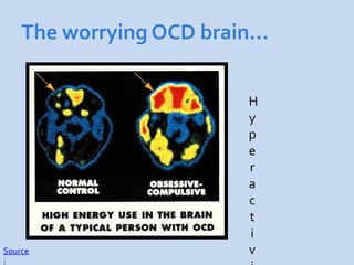 The worrying OCD brain…


                         H
                         y
                         p
                         e
                         r
                         a
                         c
                         t
                         i
Source                   v
:
 