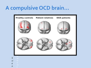 A compulsive OCD brain…
       S
       o
       ur
       ce
       :
       ht
       tp
       ://
       w
       w
       w.
       sc
       ie
       nc
       e
       d
       ail
       y.
       co
       m
       /r
       el
  S    ea
  ci   se
       s/
  e
       20
  n    0
 