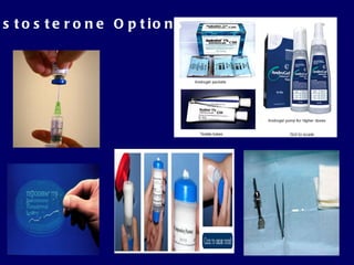 Testosterone Options 