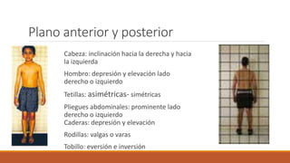 Plano anterior y posterior
Cabeza: inclinación hacia la derecha y hacia
la izquierda
Hombro: depresión y elevación lado
derecho o izquierdo
Tetillas: asimétricas- simétricas
Pliegues abdominales: prominente lado
derecho o izquierdo
Caderas: depresión y elevación
Rodillas: valgas o varas
Tobillo: eversión e inversión
 
