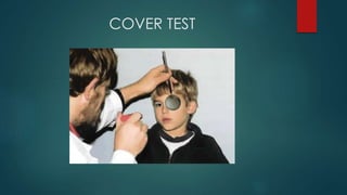COVER TEST