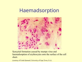 Haemadsorption
Syncytial formation caused by mumps virus and
haemadsorption of erythrocytes onto the surface of the cell
sheet.
(courtesy of Linda Stannard, University of Cape Town, S.A.)
 