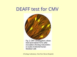DEAFF test for CMV
(Virology Laboratory, Yale-New Haven Hospital)
 