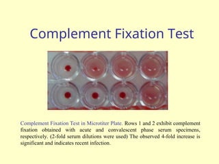 Complement Fixation Test
Complement Fixation Test in Microtiter Plate. Rows 1 and 2 exhibit complement
fixation obtained with acute and convalescent phase serum specimens,
respectively. (2-fold serum dilutions were used) The observed 4-fold increase is
significant and indicates recent infection.
 