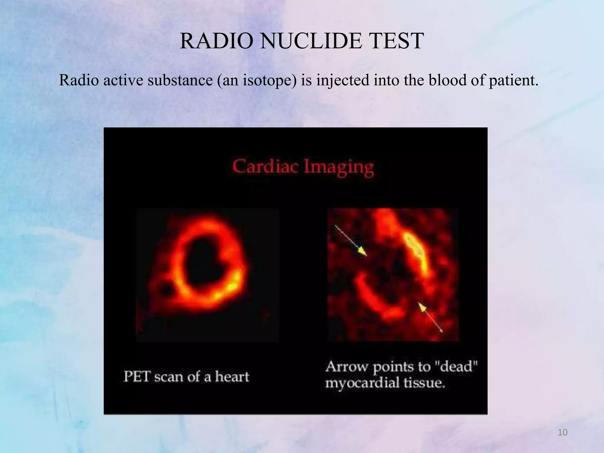 TESTS ASSOCIATED WITH CARDIAC DISORDERS.pptx