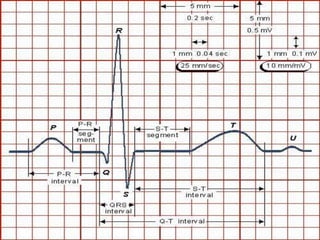 Tests associated with cardiac disorders | PPTX