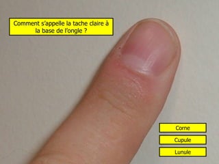 Comment s’appelle la tache claire à la base de l’ongle ? Cupule Lunule Corne 
