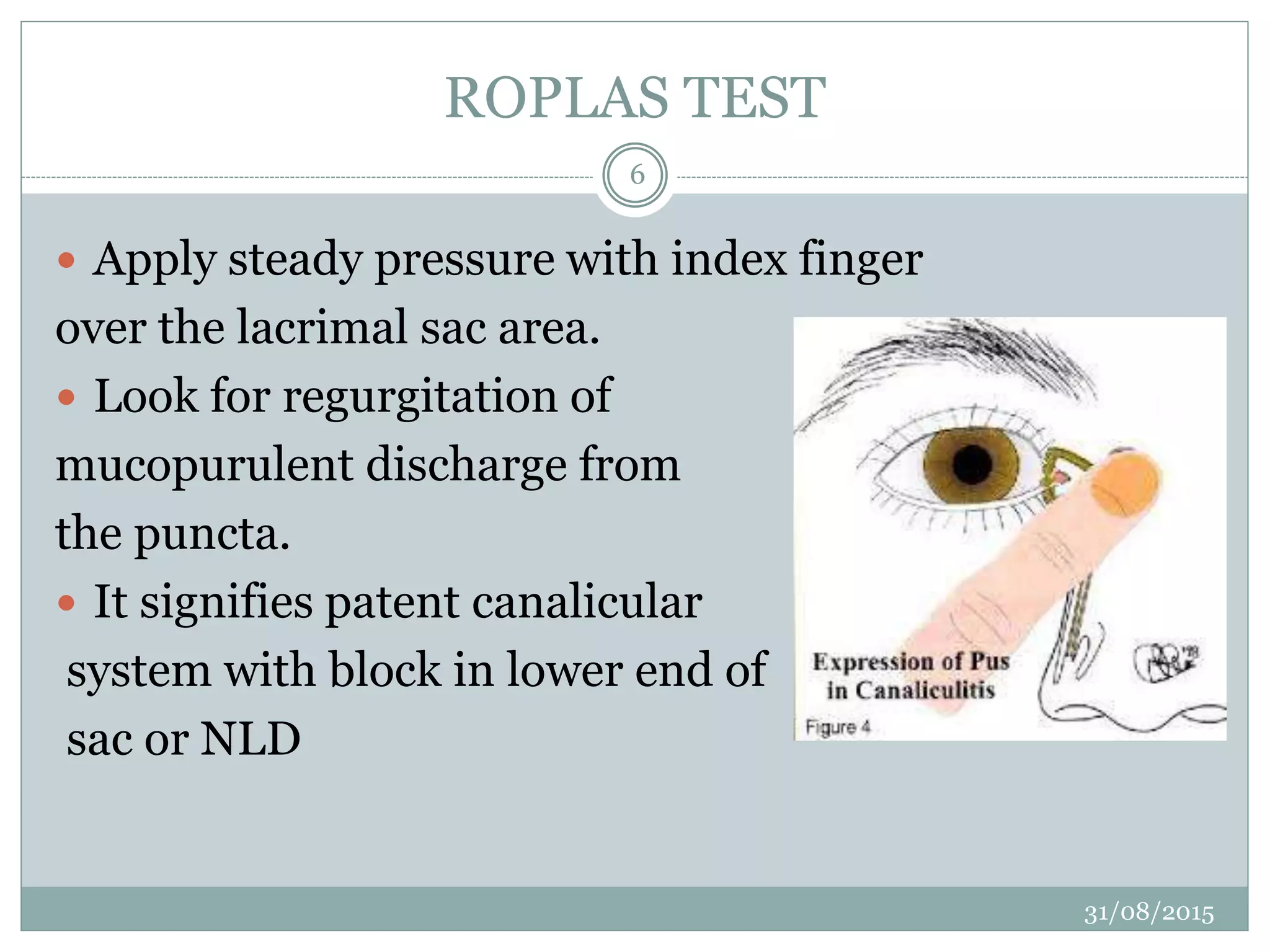 Tests done to assess patency of lacrimal drainage | PPTX