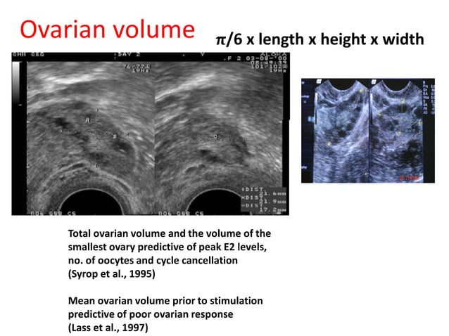Tests for ovarian reserve | PDF | Infertility | Reproductive Health