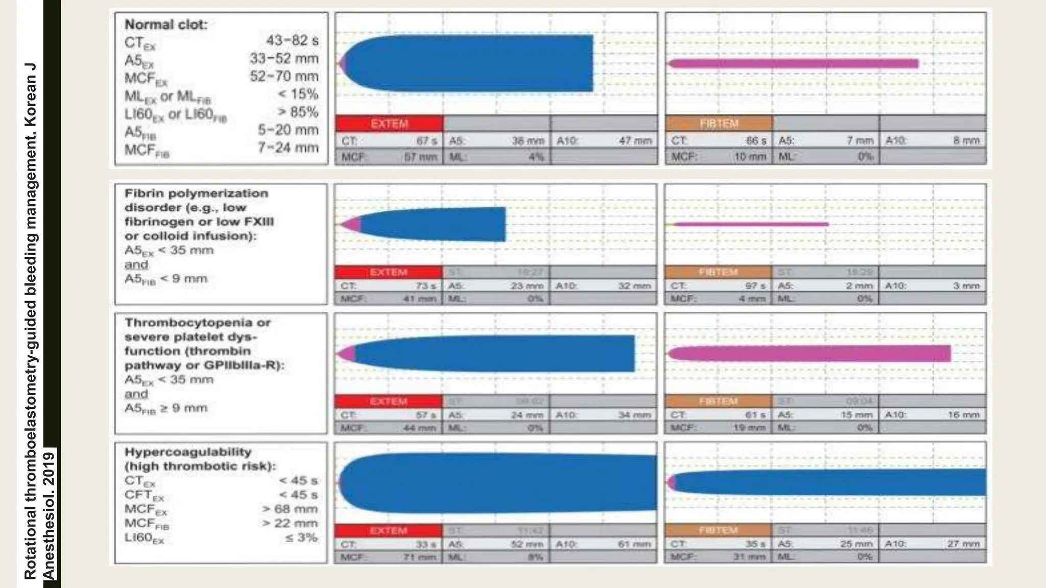 Rotational
thromboelastometry-guided
bleeding
management.
Korean
J
Anesthesiol.
2019
 