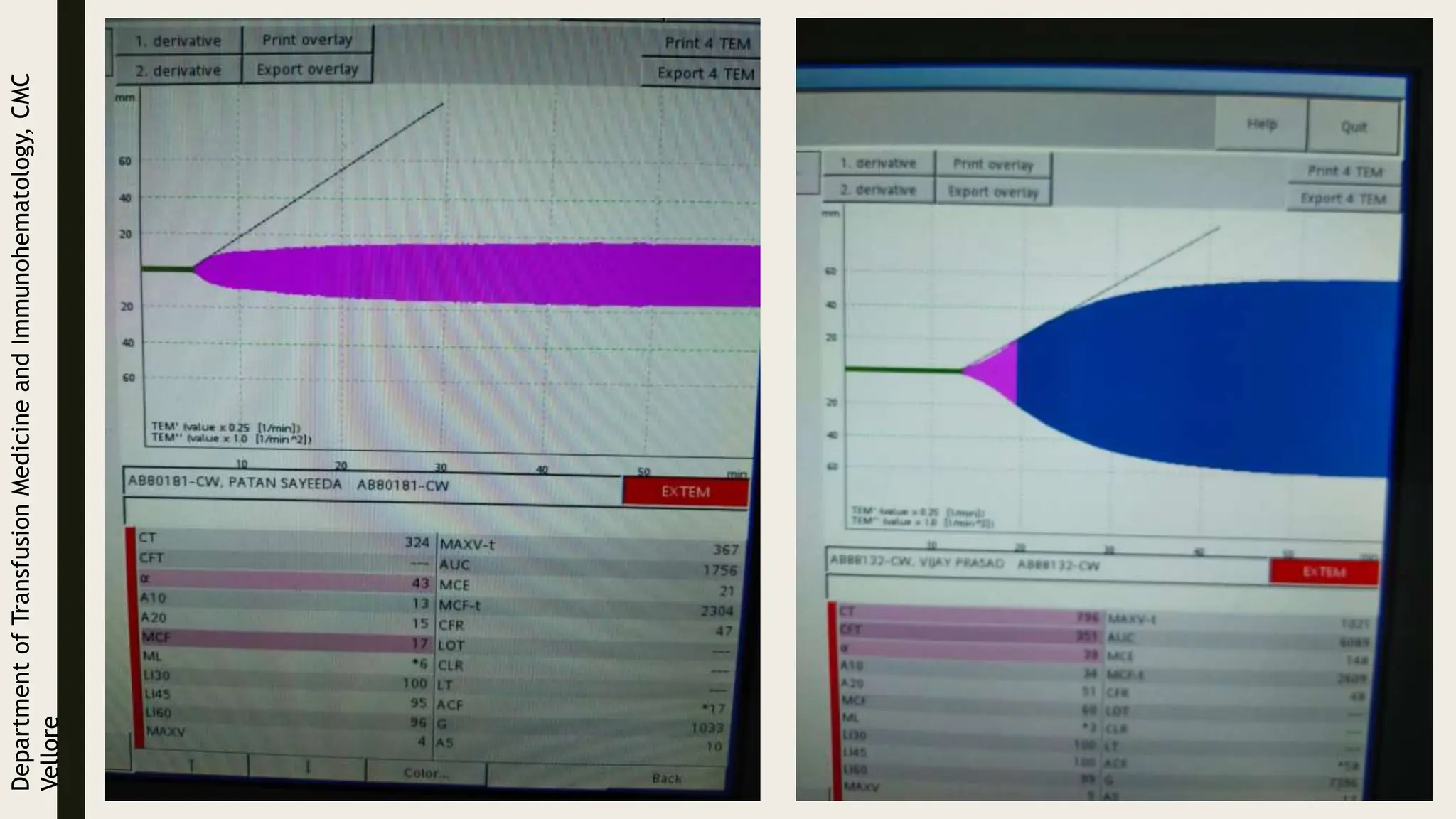 Department
of
Transfusion
Medicine
and
Immunohematology,
CMC
Vellore
 