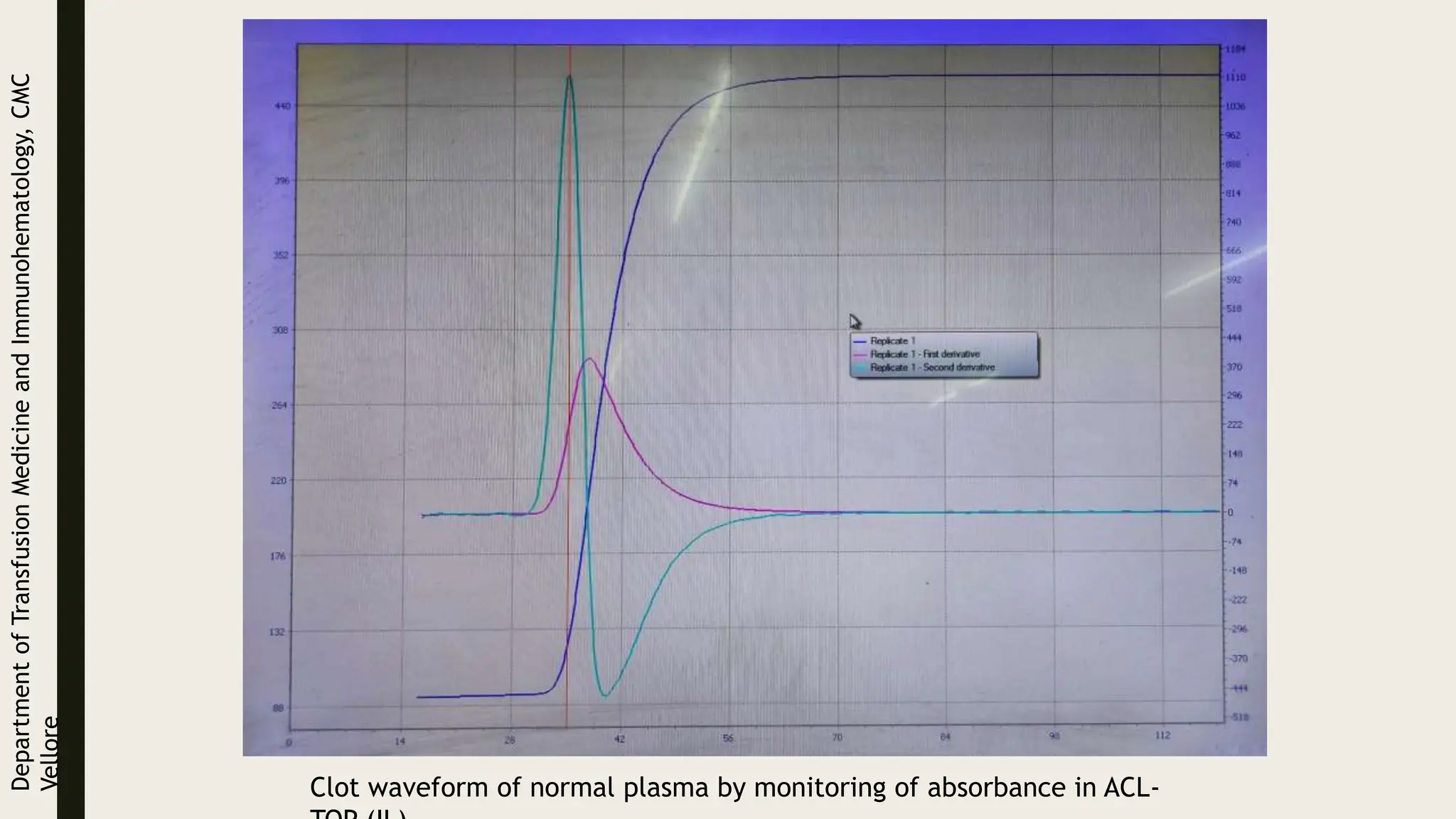 Clot waveform of normal plasma by monitoring of absorbance in ACL-
Department
of
Transfusion
Medicine
and
Immunohematology,
CMC
Vellore
 