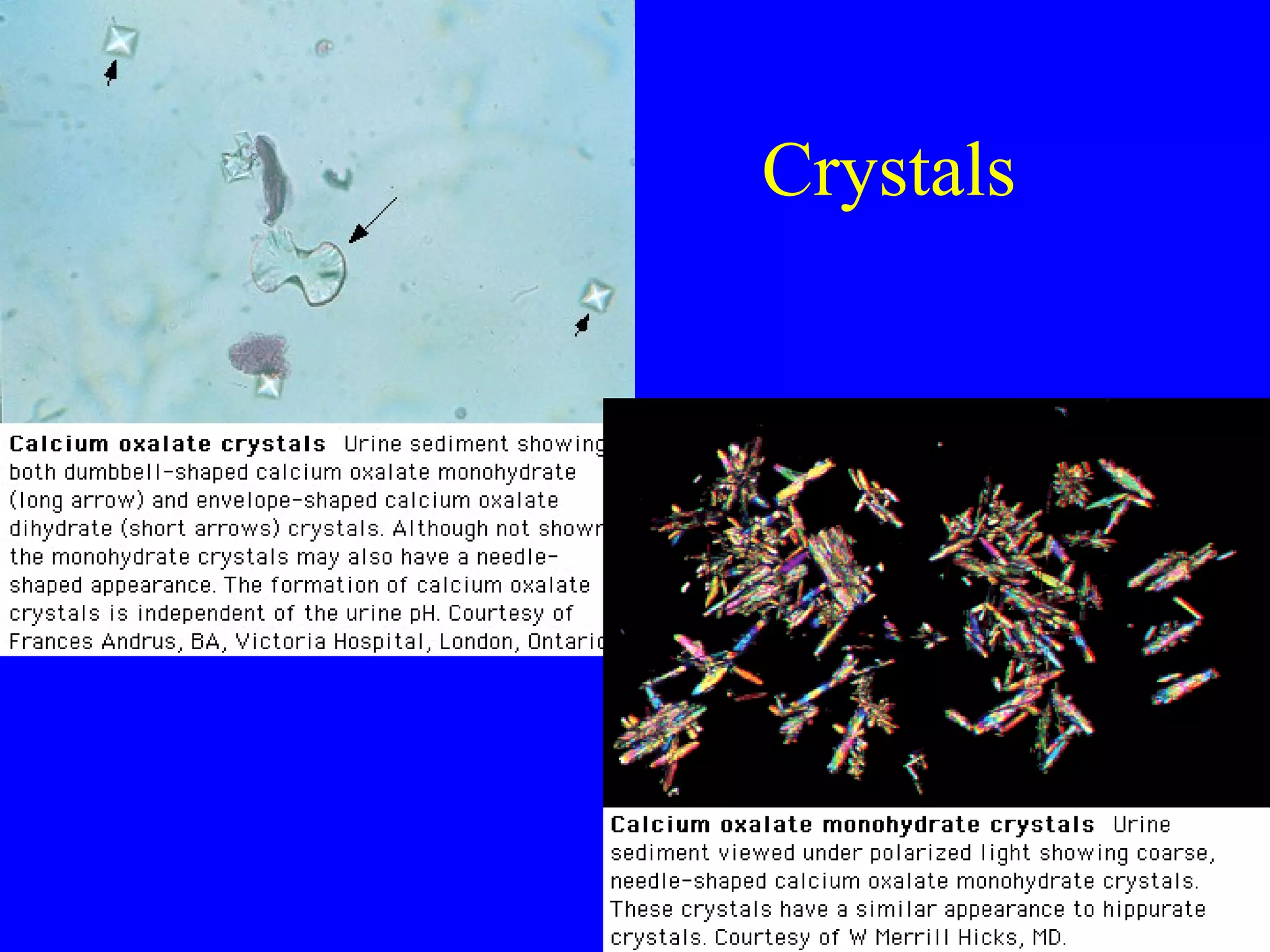 Crystals
 