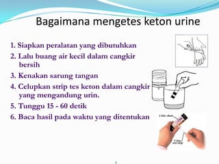 Bagaimana mengetes keton urine
1. Siapkan peralatan yang dibutuhkan
2. Lalu buang air kecil dalam cangkir
   bersih
3. Kenakan sarung tangan
4. Celupkan strip tes keton dalam cangkir
   yang mengandung urin.
5. Tunggu 15 - 60 detik
6. Baca hasil pada waktu yang ditentukan




                              4
 