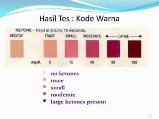 Hasil Tes : Kode Warna




   no ketones
   trace
   small
   moderate
   large ketones present

                            5
 